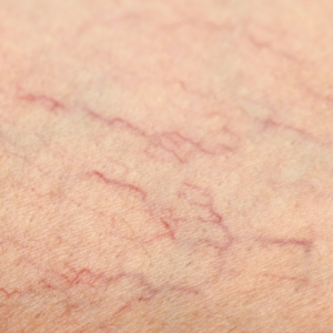 a close up of a veins